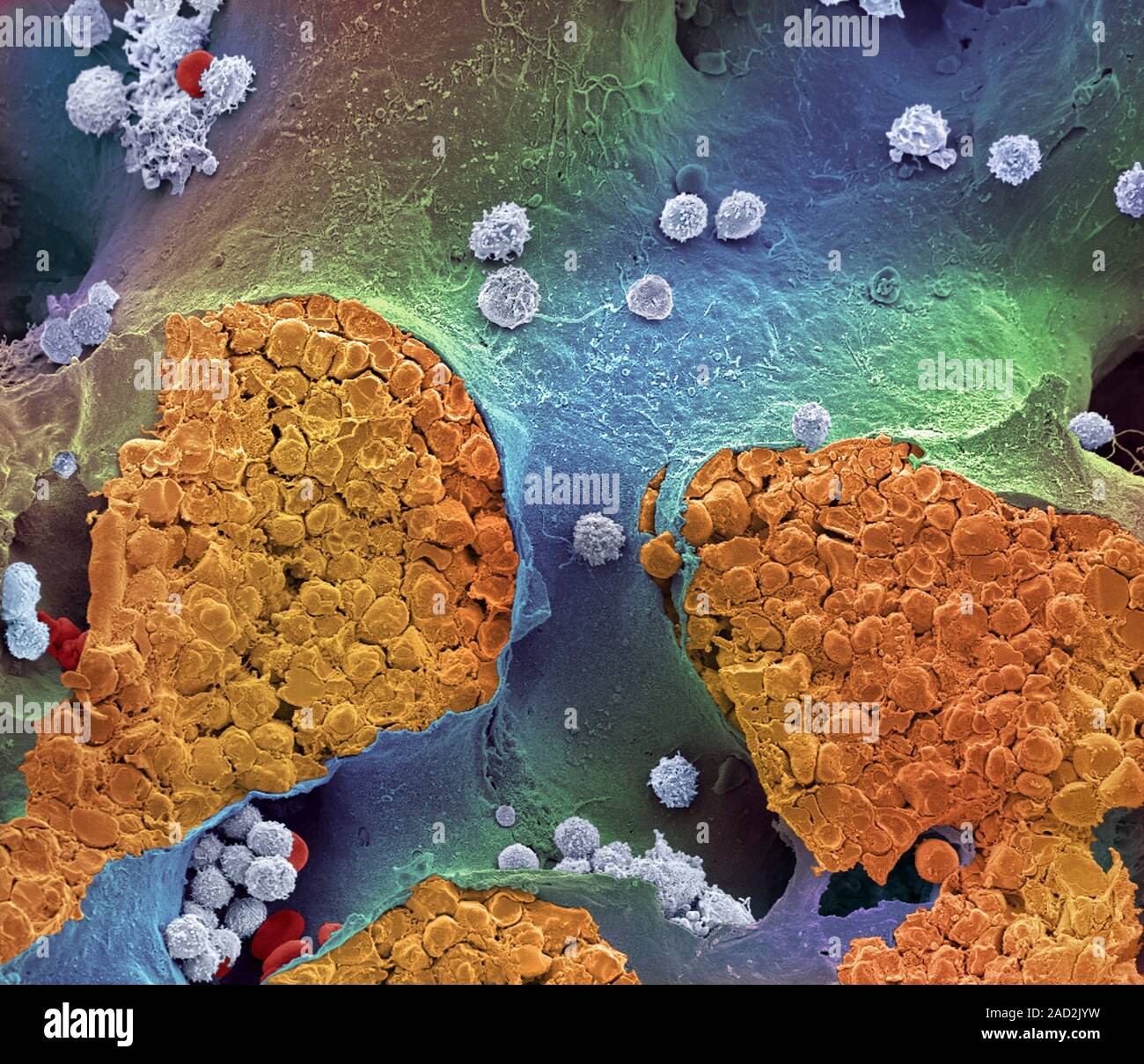 Bone marrow. Coloured scanning electron micrograph (SEM) of bone marrow