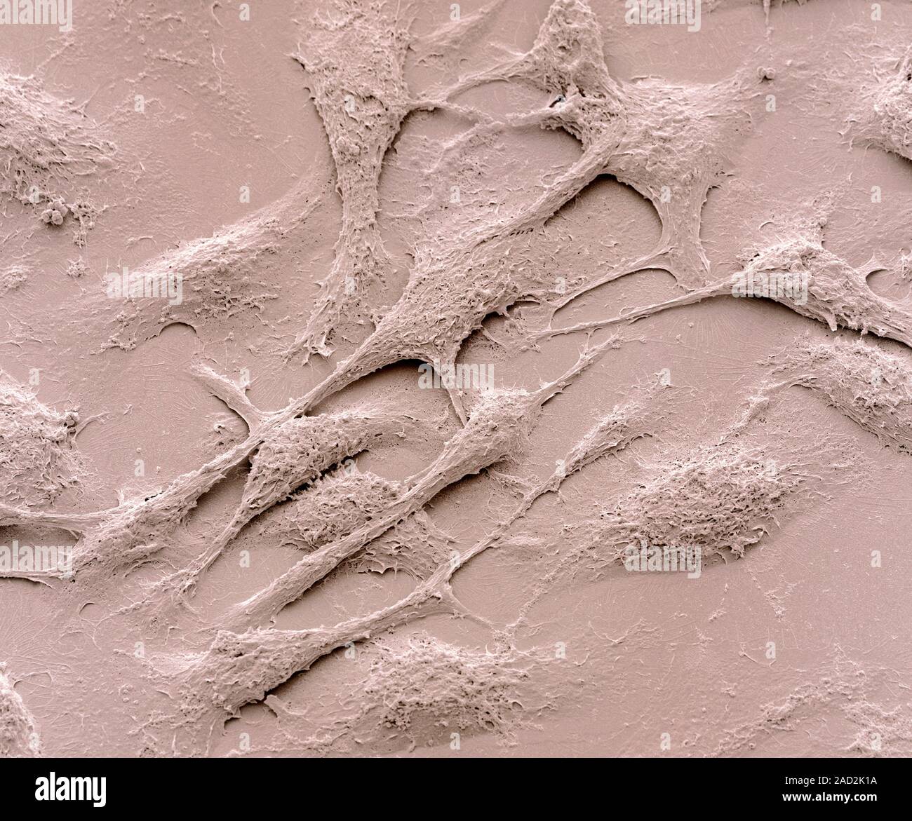 Keratinocyte skin cells. Coloured scanning electron micrograph (SEM) of human cultured