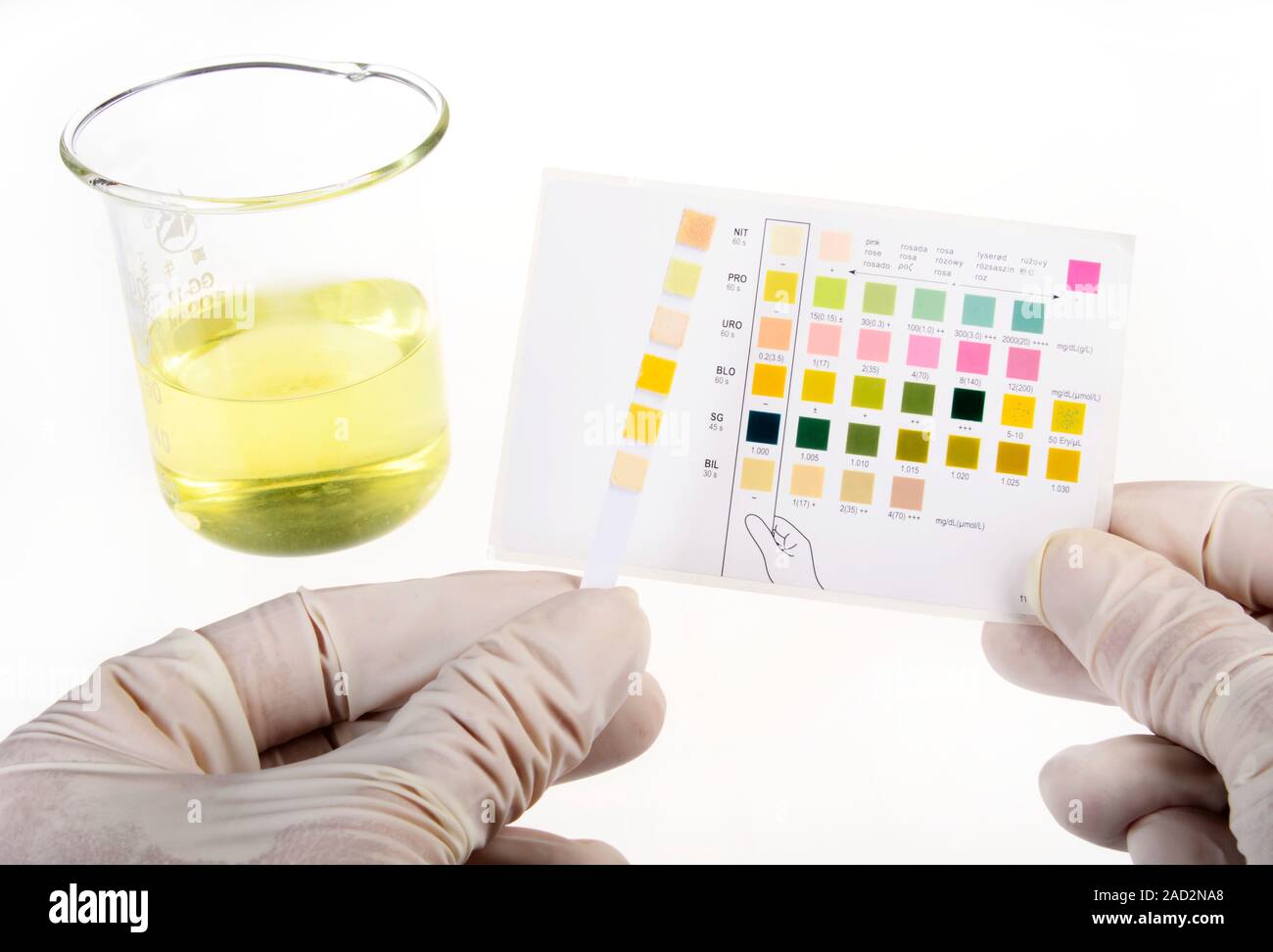 Home urine test. Home test kit for testing urine for signs of heart, liver and kidney problems