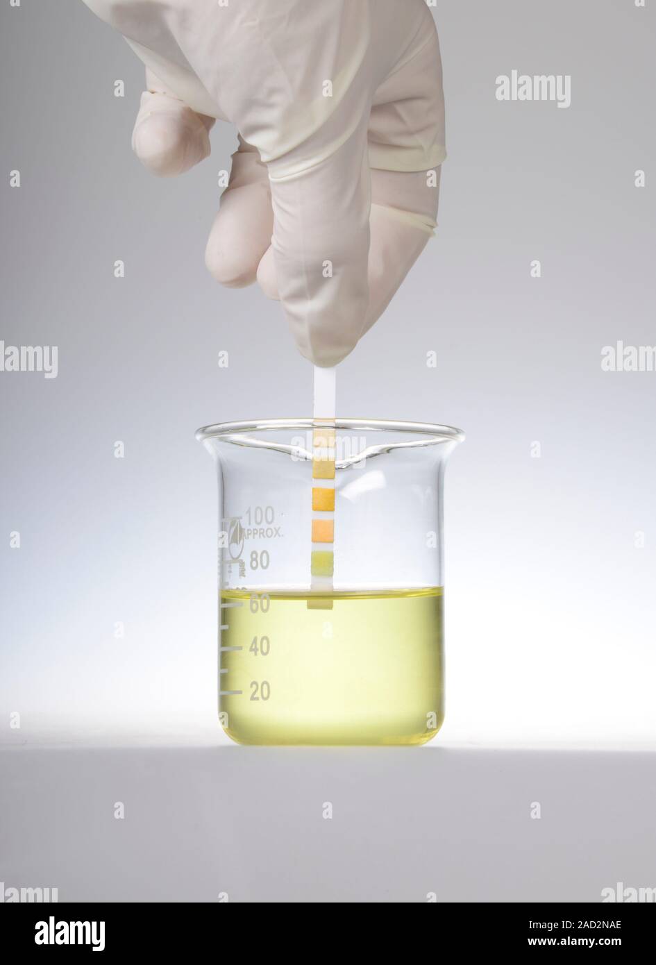Home urine test. Home test kit for testing urine for signs of heart