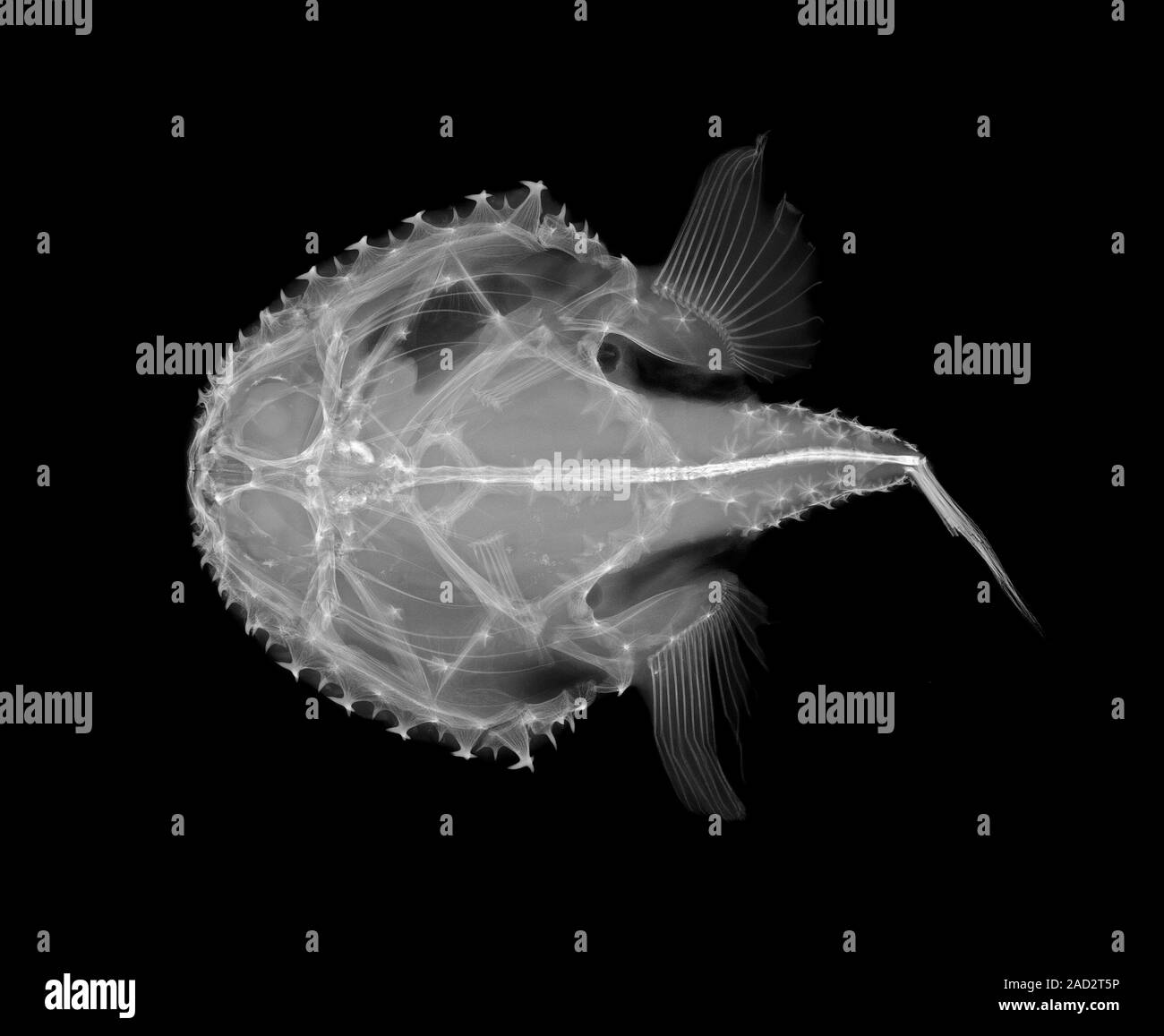 Pancake batfish (Halieutichthys aculeatus). Xray of a section through a pancake batfish