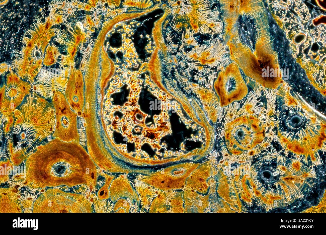 Silverstained section of adult bone tissue viewed with darkfield light