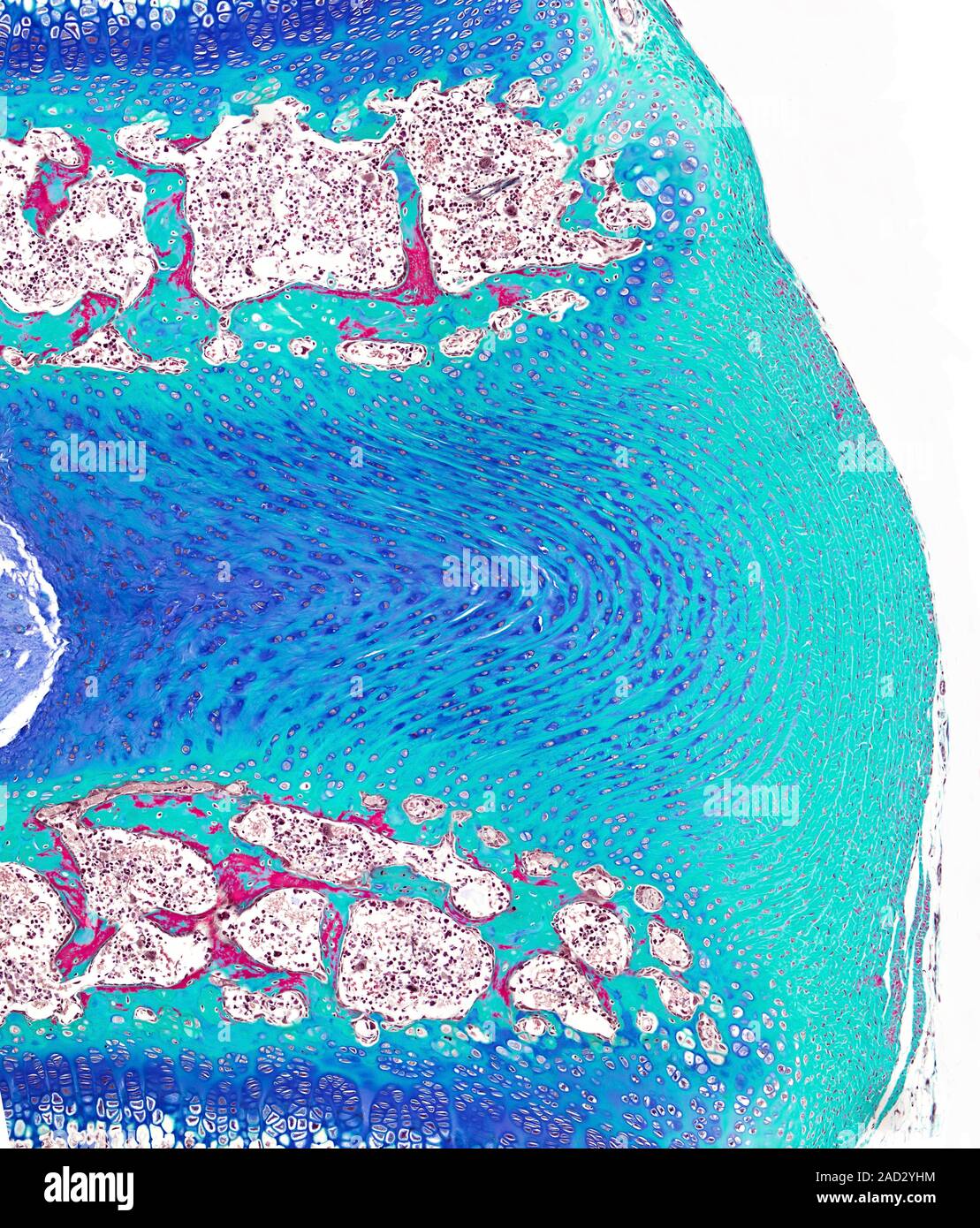 Light microscopy of part of a intervertebral disc located between two