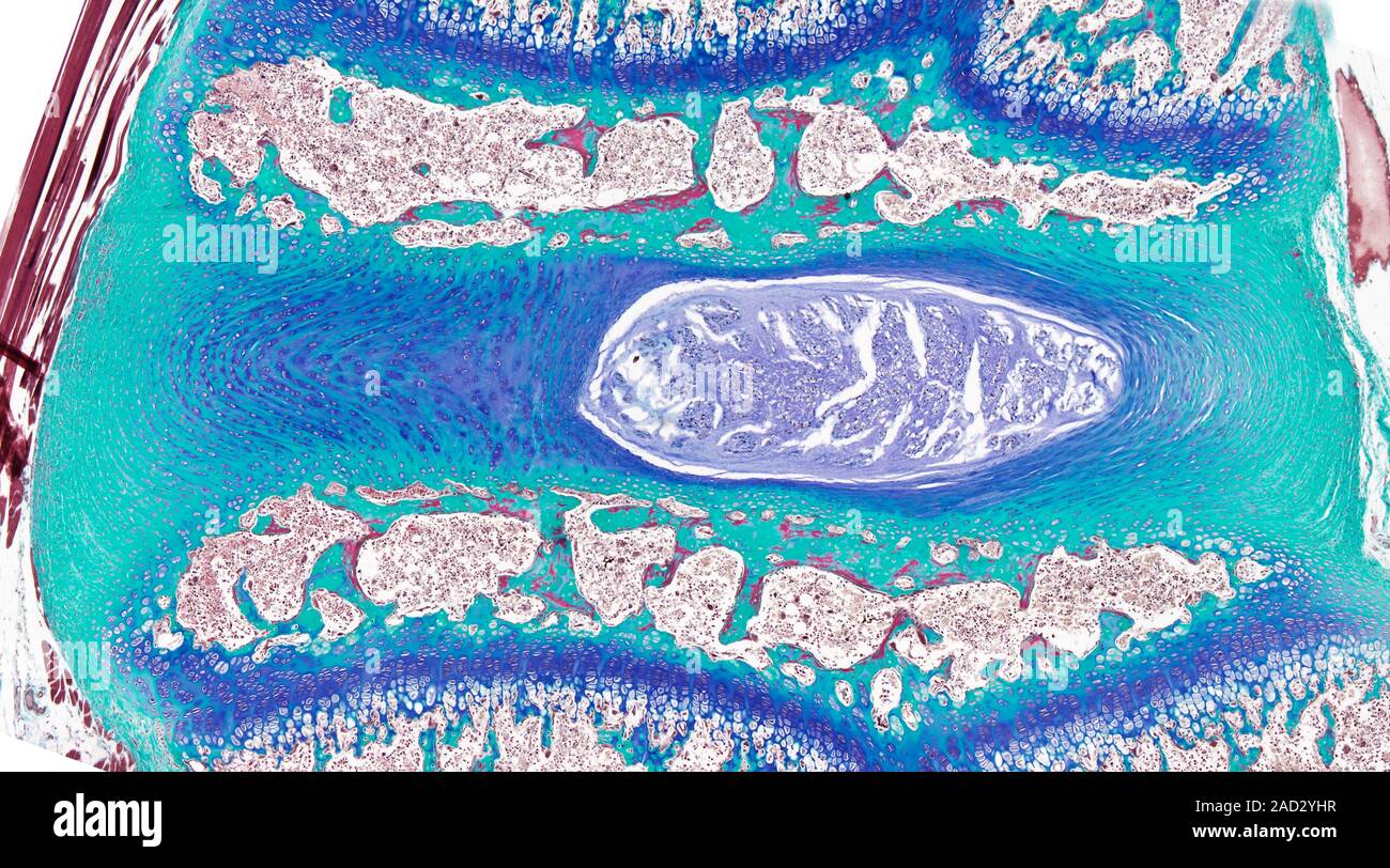 Light microscopy of an intervertebral disc between two developing