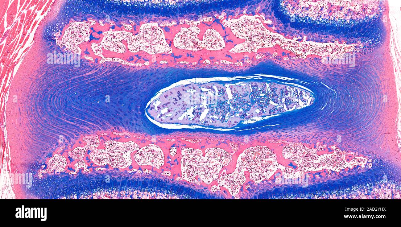 Light microscopy of an intervertebral disc between two developing