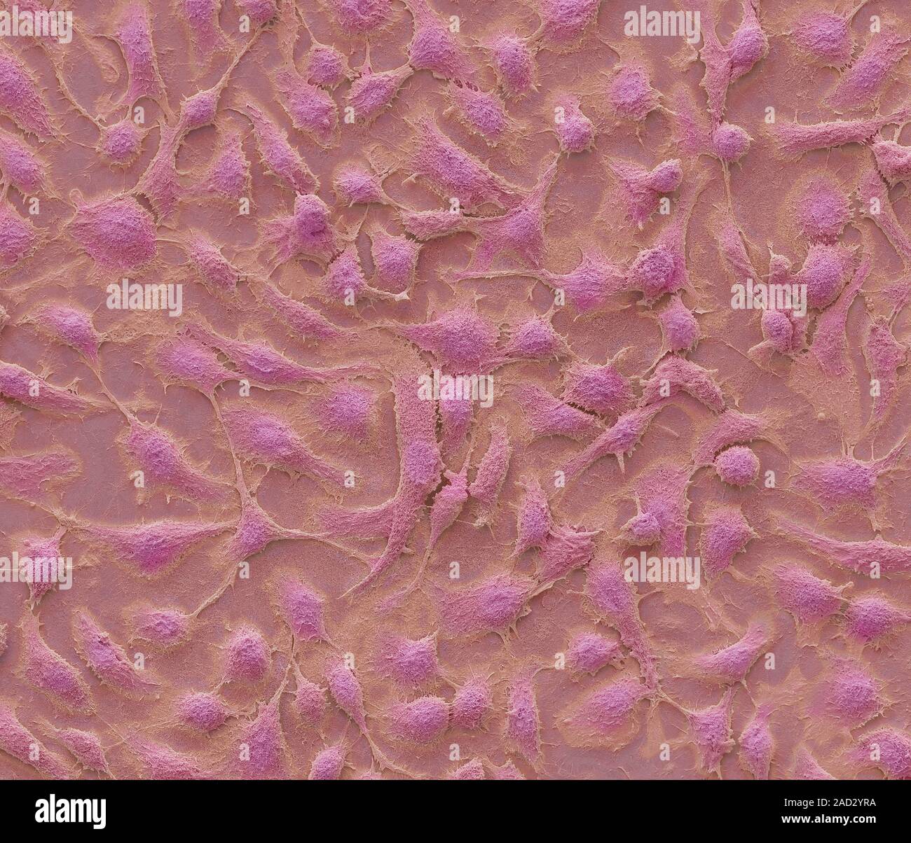 Keratinocyte skin cells. Coloured scanning electron micrograph (SEM) of human cultured