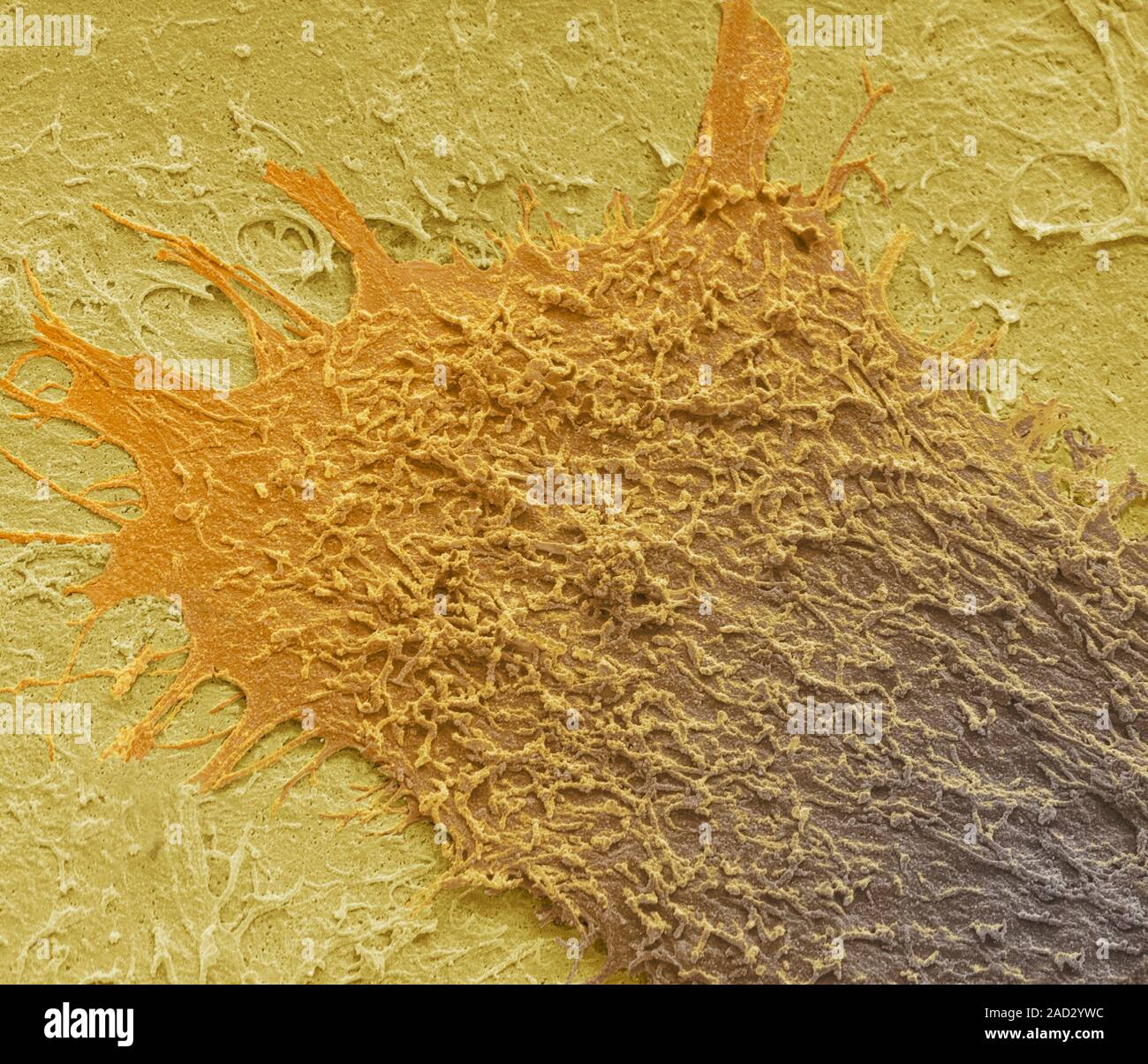 Keratinocyte skin cell. Coloured scanning electron micrograph (SEM) of