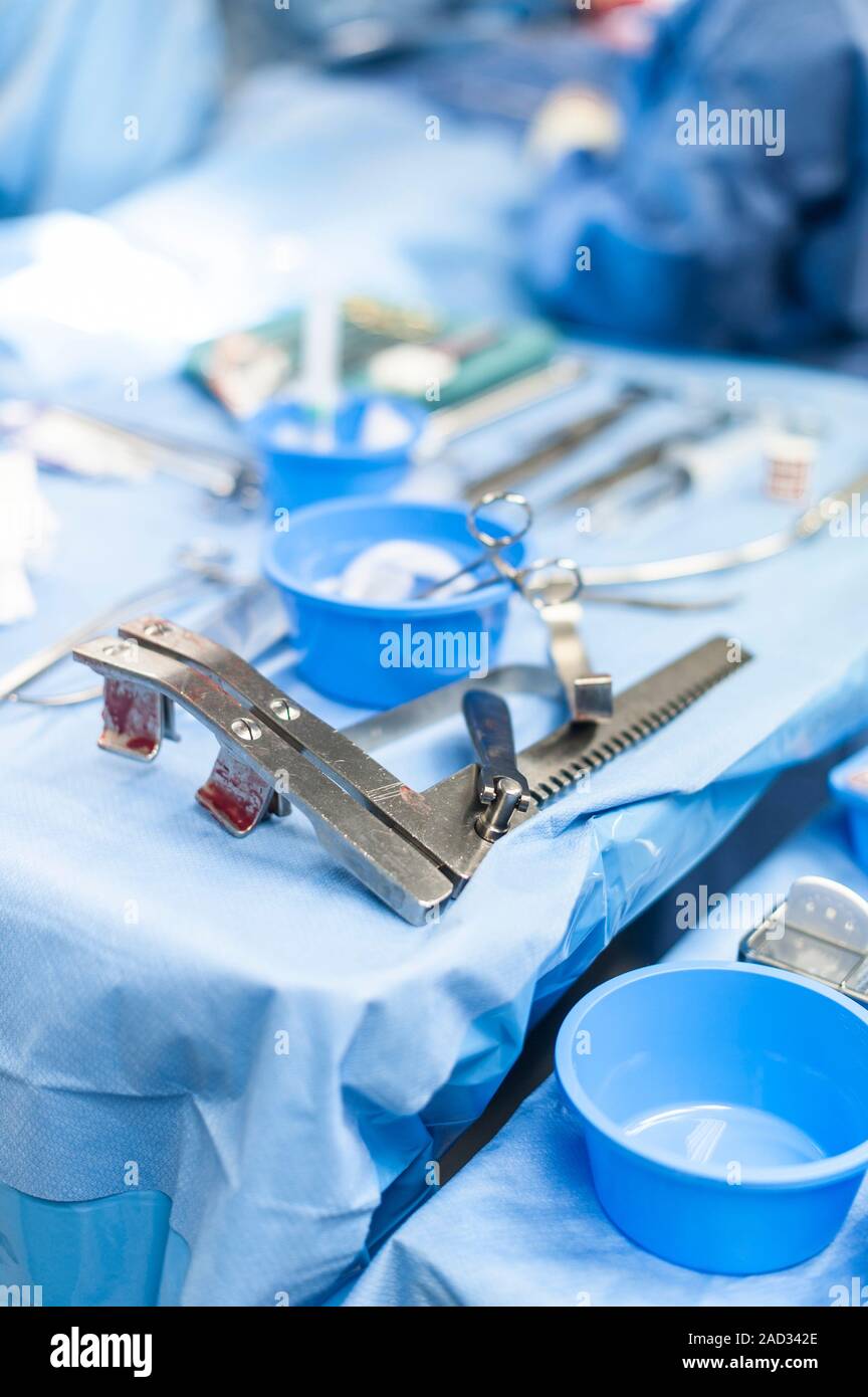 Surgical clamps. Closeup of surgical clamps being used during an