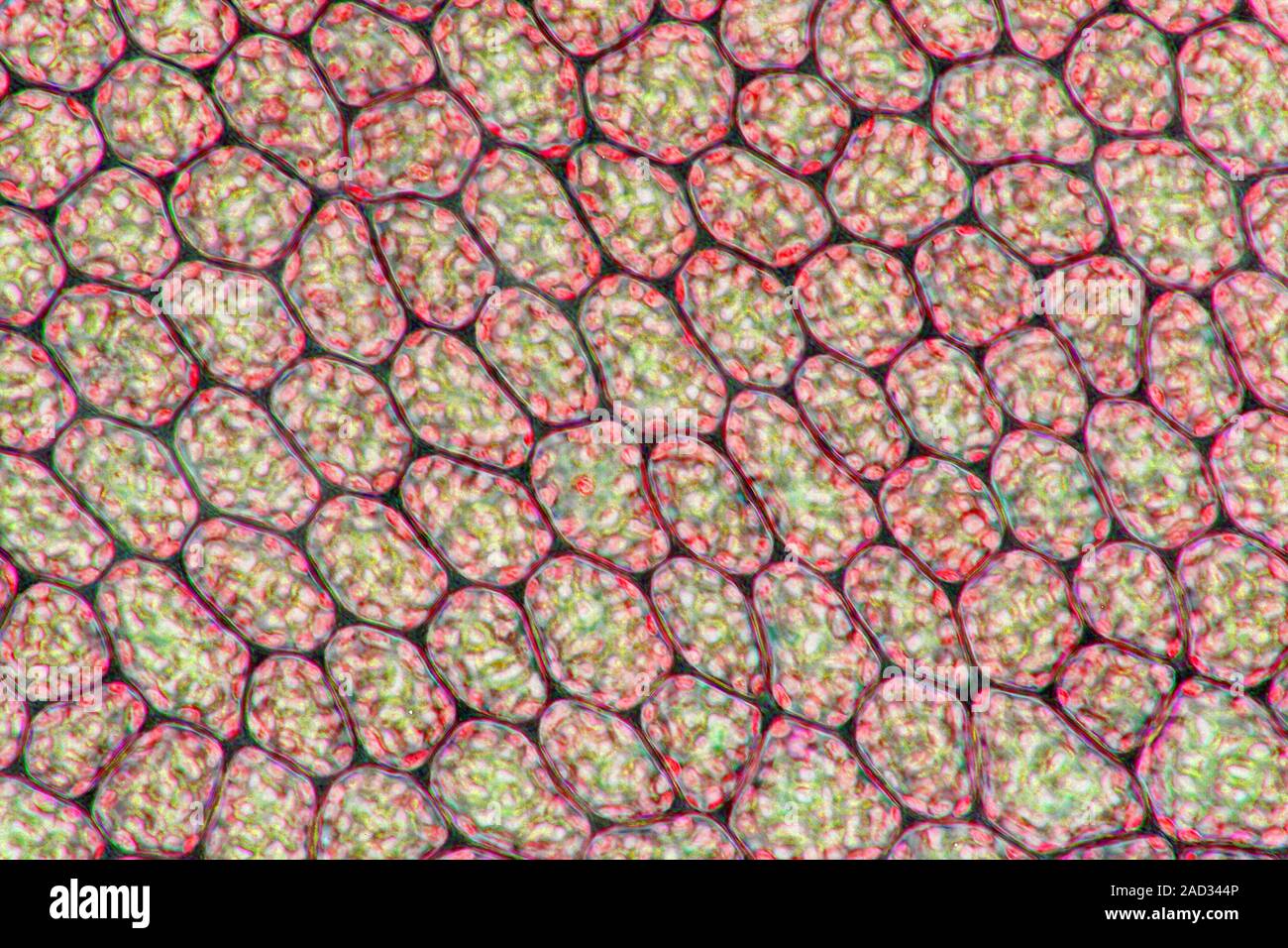 Moss leaf. Light micrograph of a section through a leaf from a moss ...