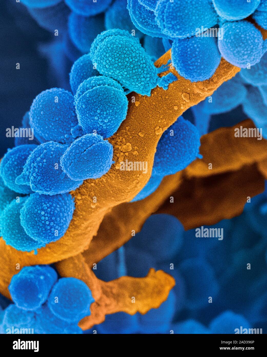 Oral Streptococcus bacteria. Coloured scanning electron micrograph (SEM ...