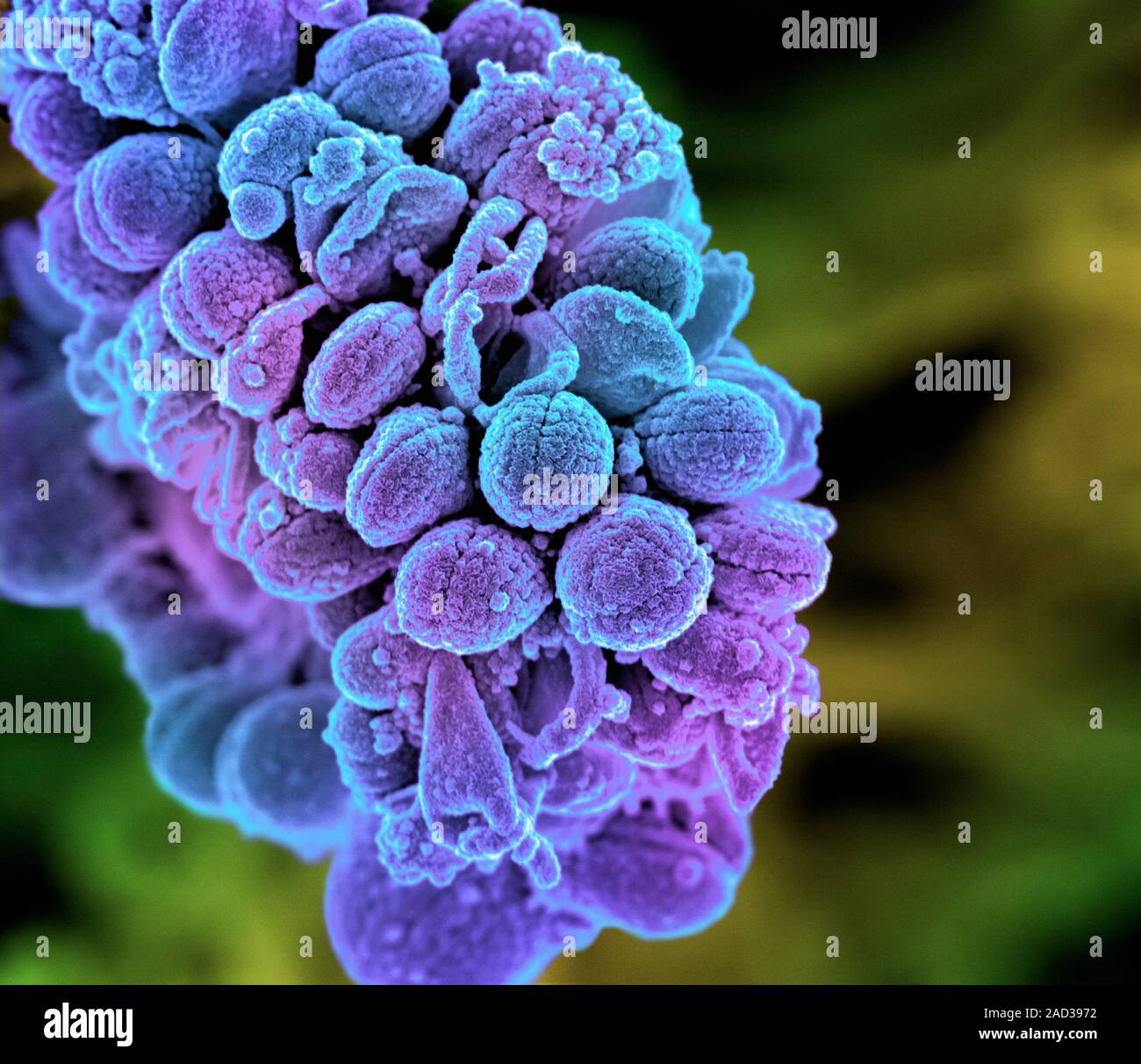 Streptococcus bacteria. Coloured scanning electron micrograph (SEM) of ...