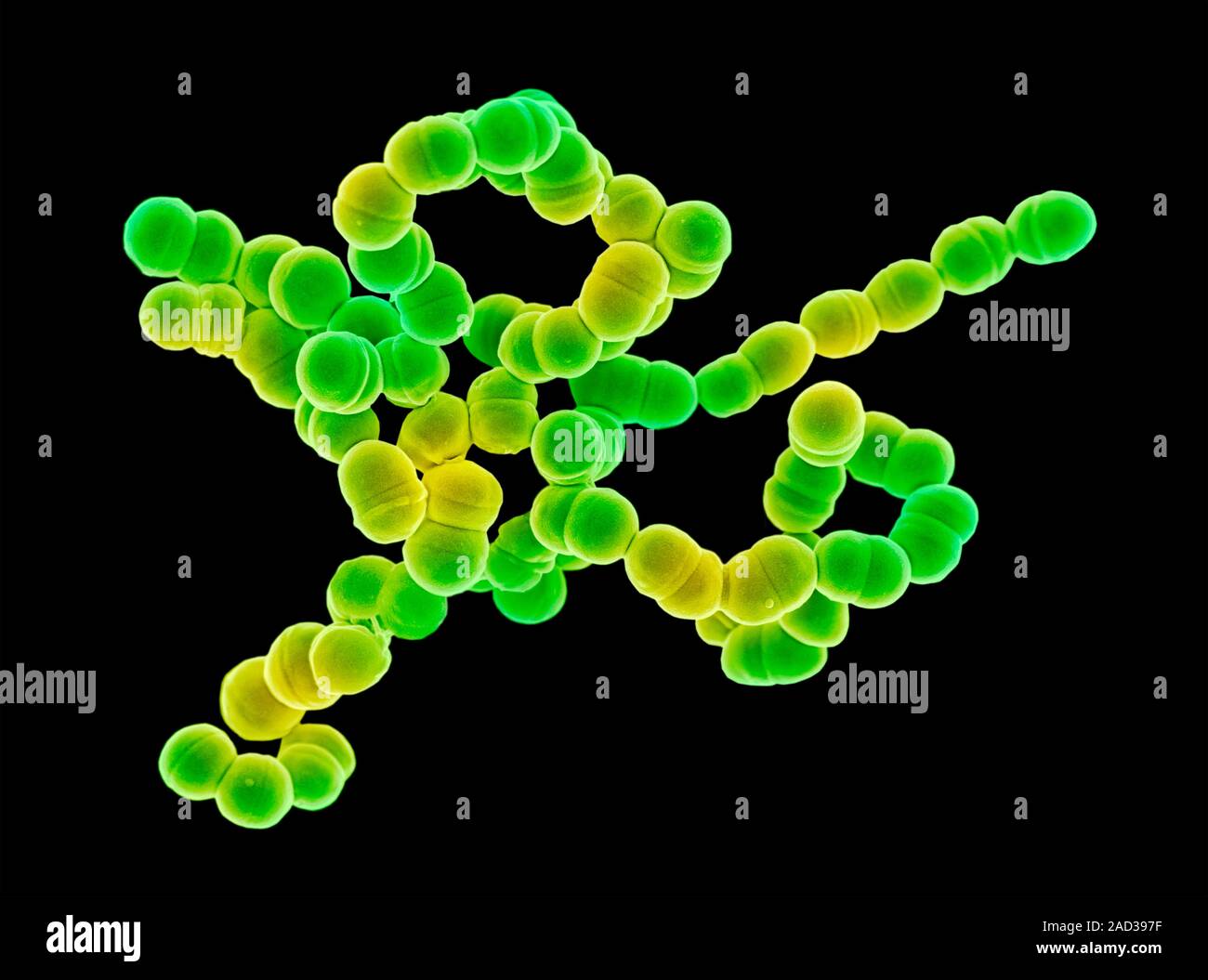 Streptococcus bacteria. Coloured scanning electron micrograph (SEM) of ...