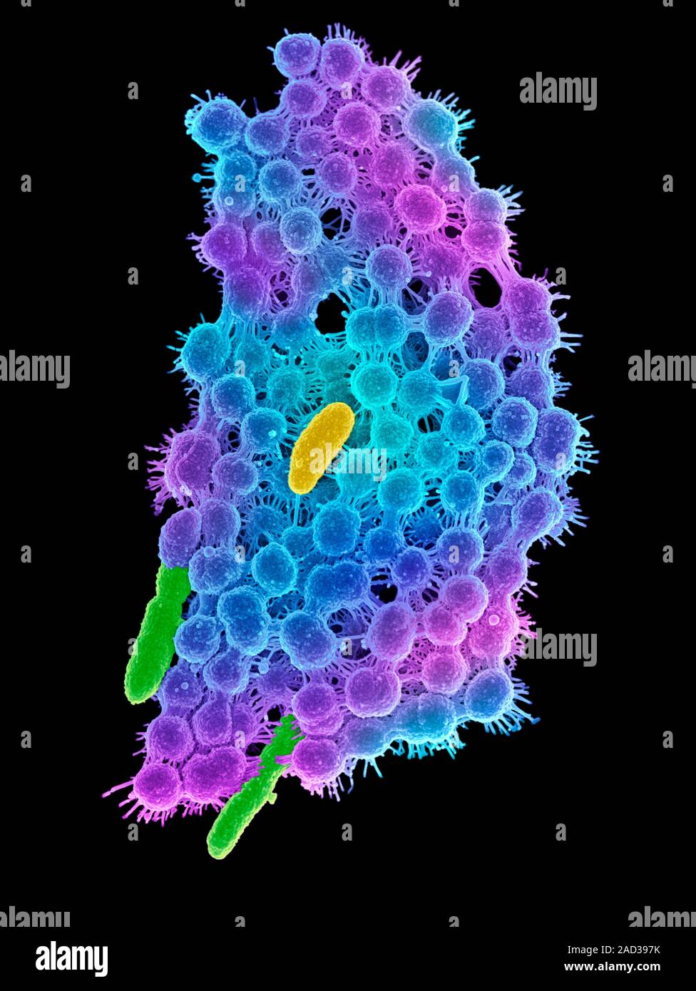 Saliva and bacteria. Coloured scanning electron micrograph (SEM) of a ...
