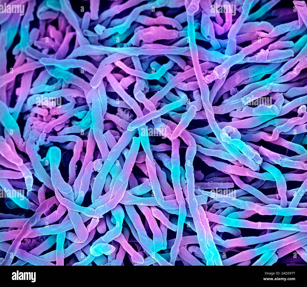 Streptomyces thermophilic bacteria. Coloured scanning electron ...