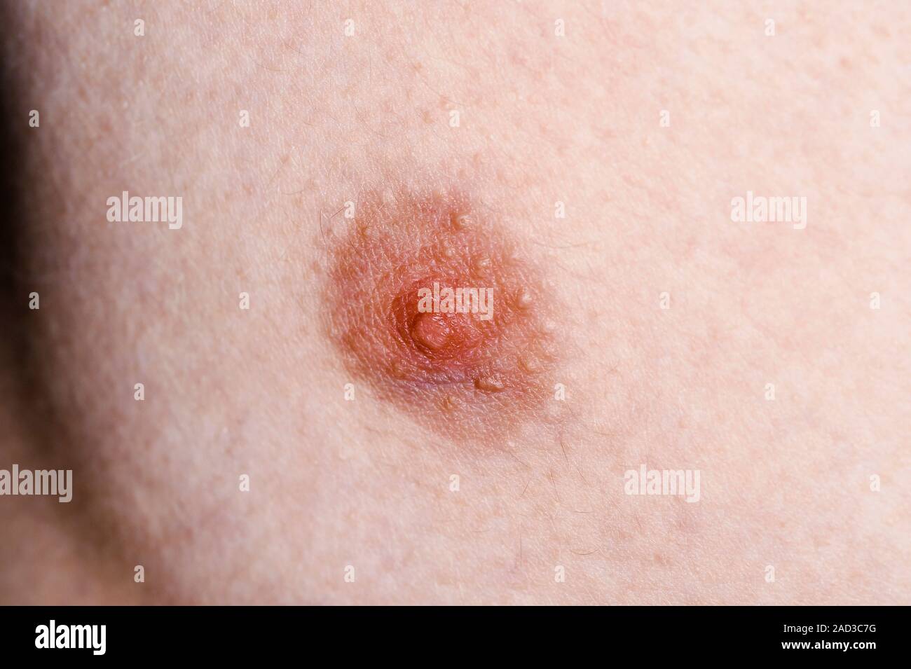 Nipple Close Up Pic