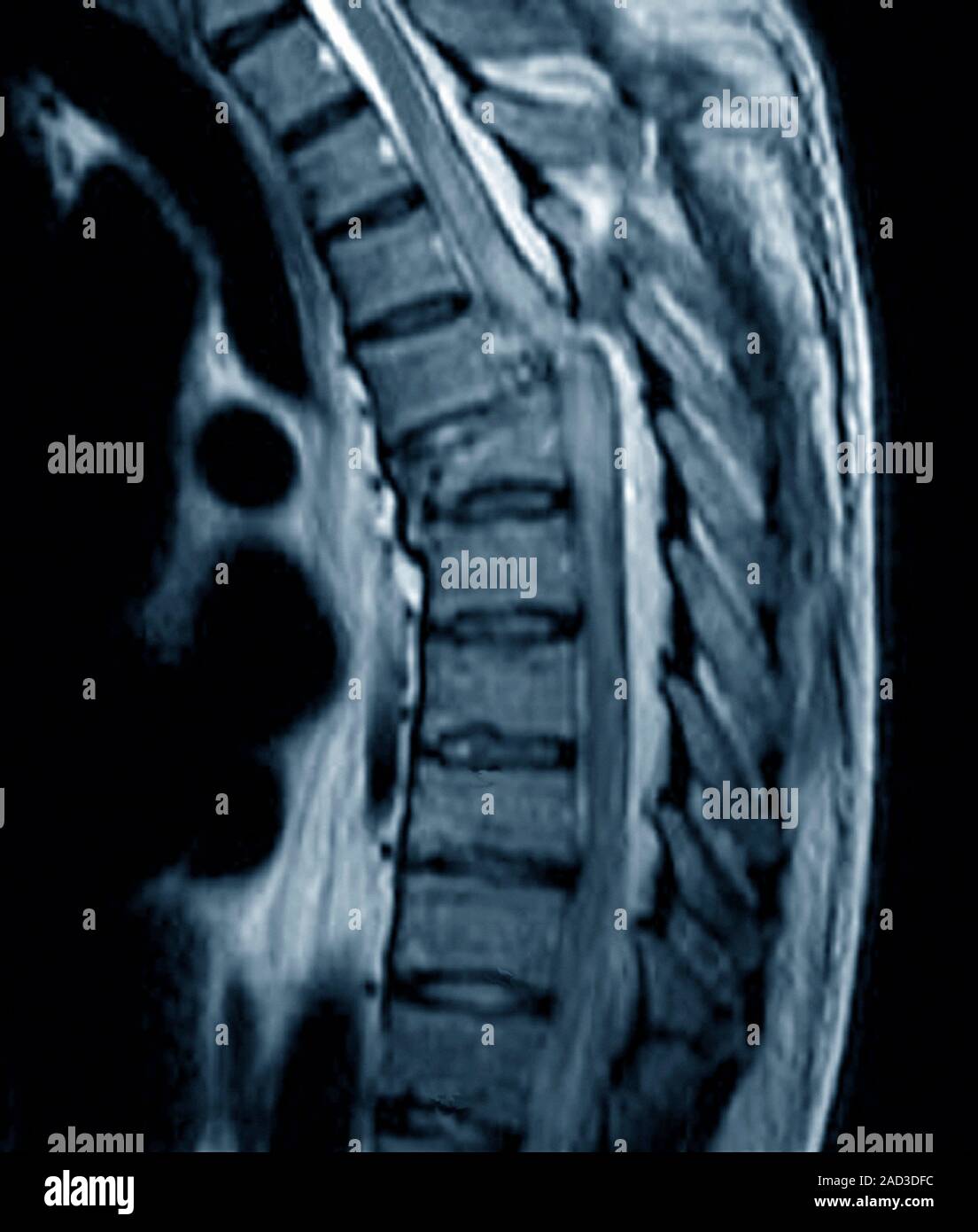 Musculoskeletal MRI Quick Reference Guide for Patients