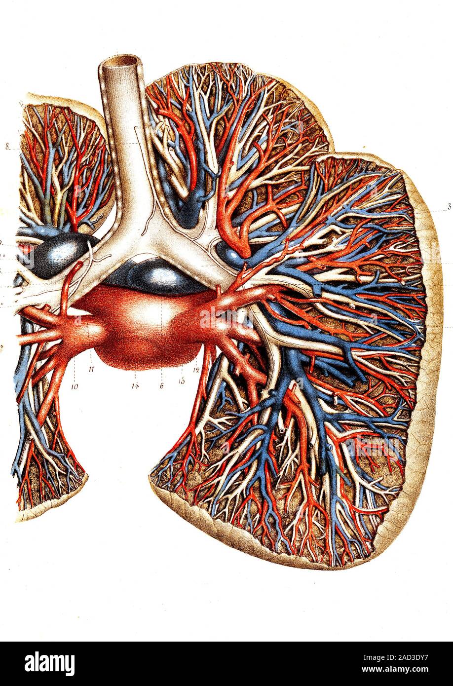 дивертикулы трахеи и бронхов. бронхоэктатическая болезнь (бэб). расширенные сосуды бронхов. бронхоэктатическая болезнь бронхоскопия. профузное легочное кровотечение.