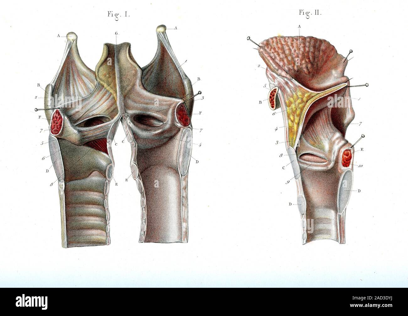 Voicebox Voice box anatomy. 1866 anatomical illustration showing the internal ...