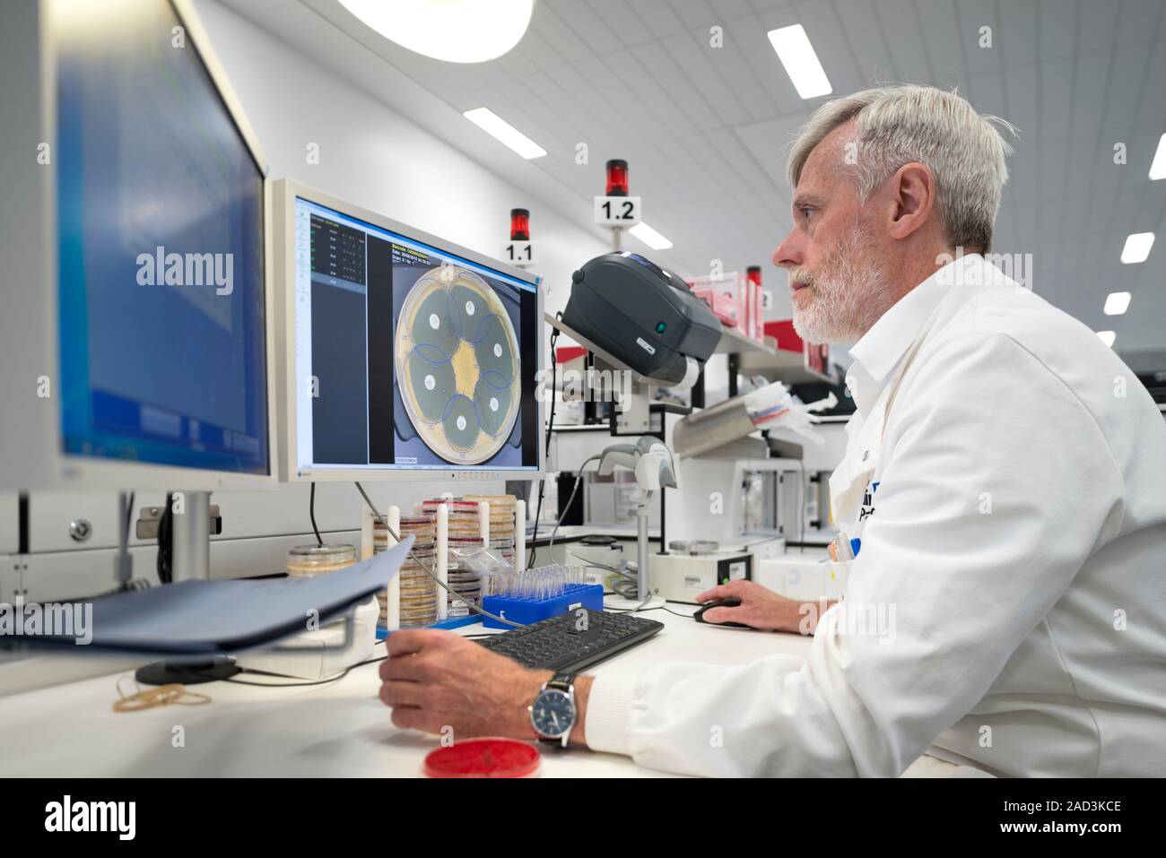 Hospital pathology lab. Microbiologist using a KIESTRA automated