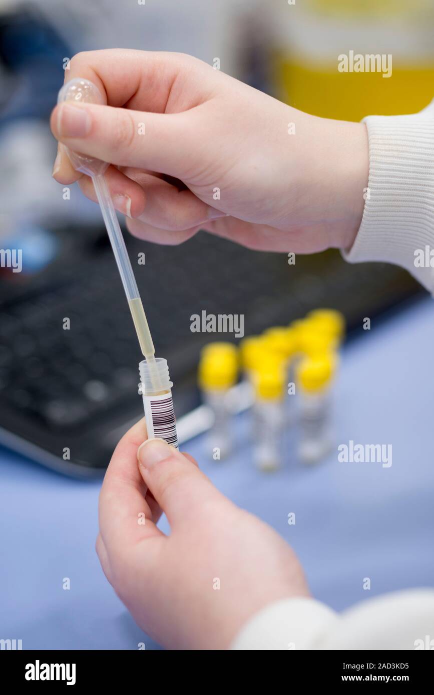 Hospital pathology lab. Close-up of a microbiologist collecting samples ...