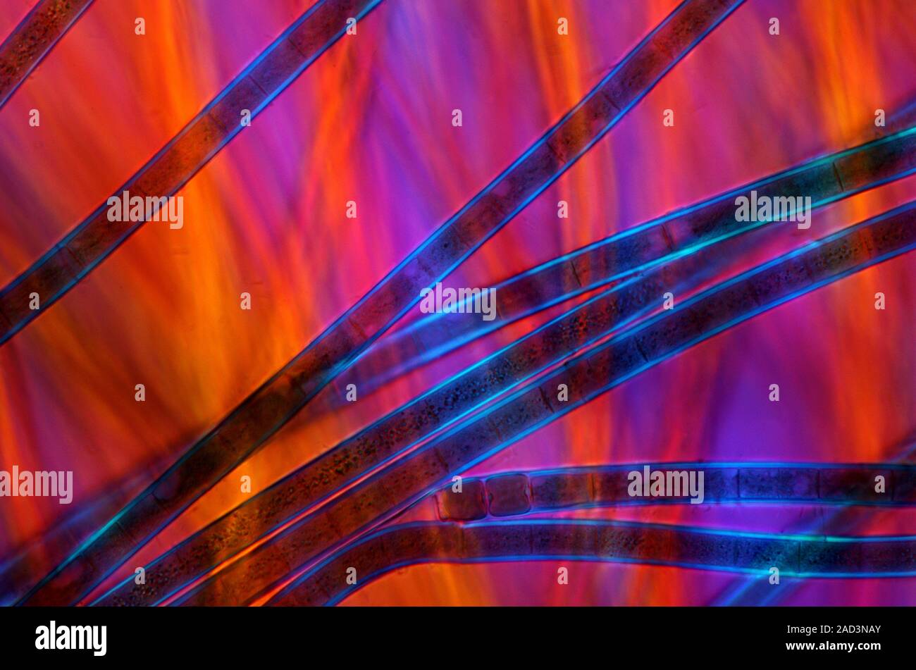 Cyanobacteria. Polarised light micrograph of filamentous cyanobacteria ...