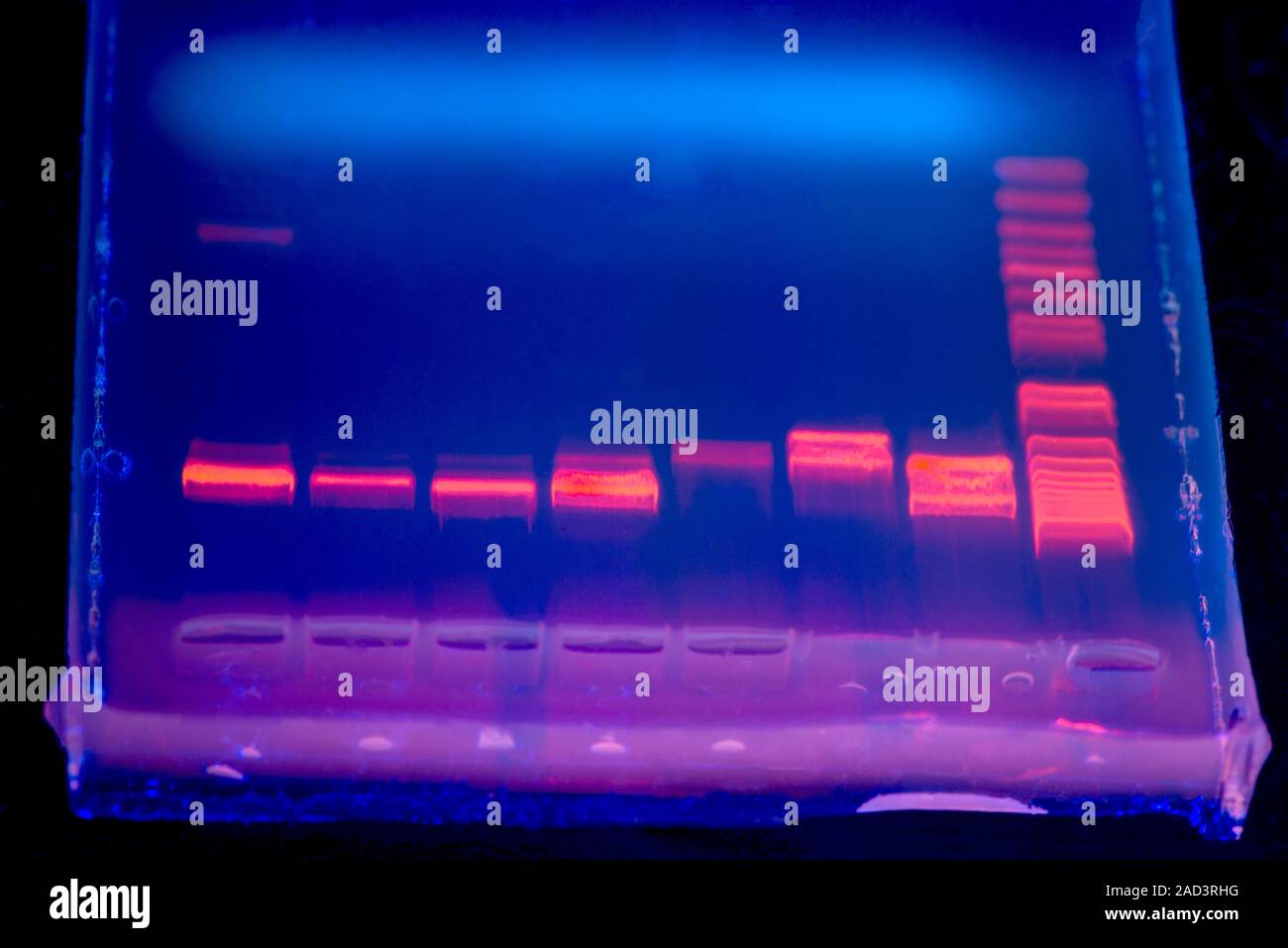 DNA electrophoresis under UV light. Closeup of a DNA (deoxyribonucleic