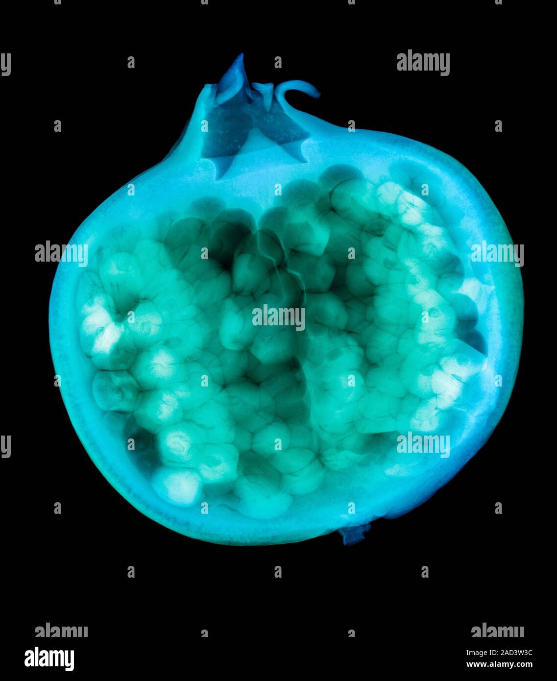 Pomegranate. Coloured X-ray of a fruit from a pomegranate (Punica ...