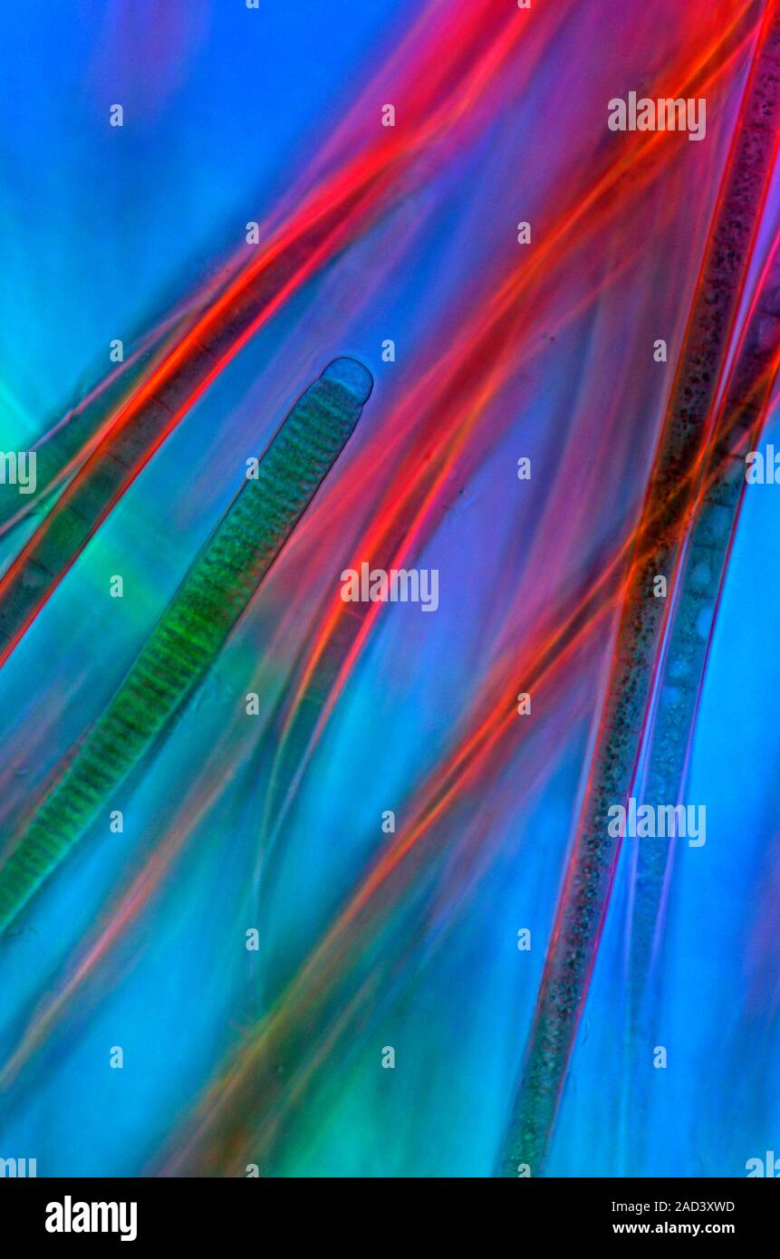 Oscillatoria cyanobacteria. Polarised light micrograph of filamentous