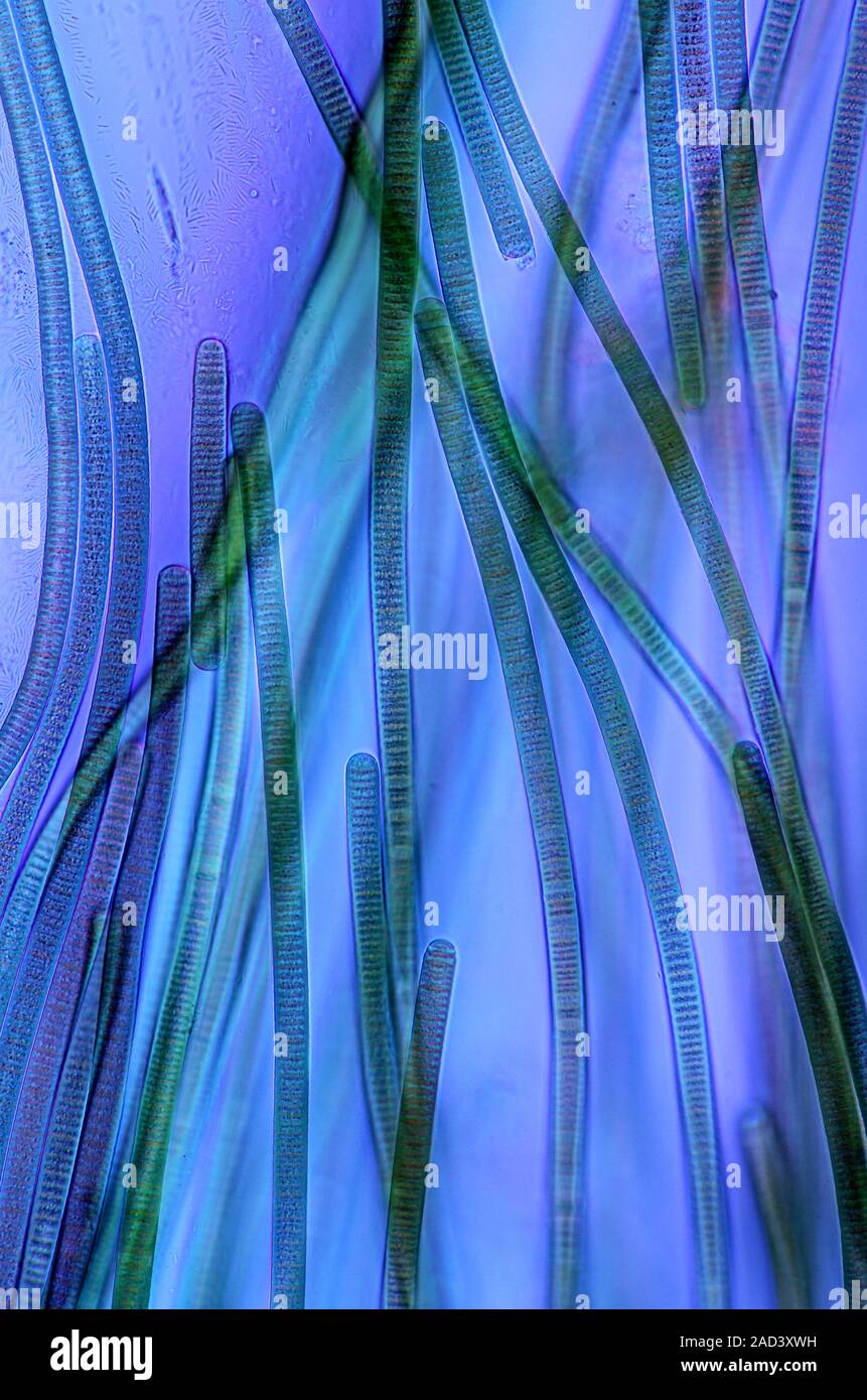 Oscillatoria cyanobacteria. Polarised light micrograph of filamentous