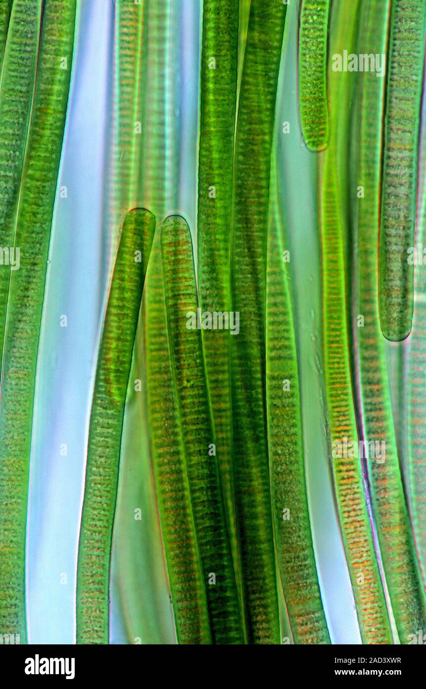 Oscillatoria cyanobacteria. Polarised light micrograph of filamentous