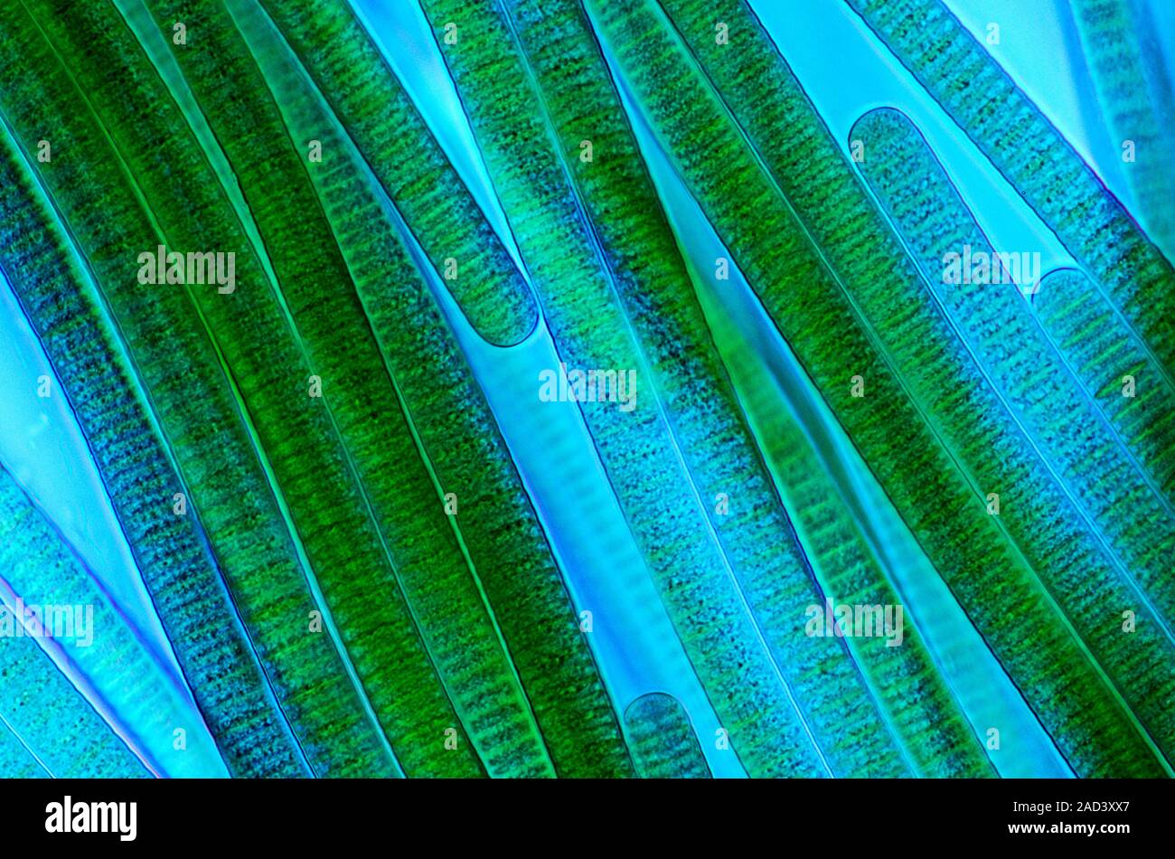 Oscillatoria cyanobacteria. Polarised light micrograph of filamentous