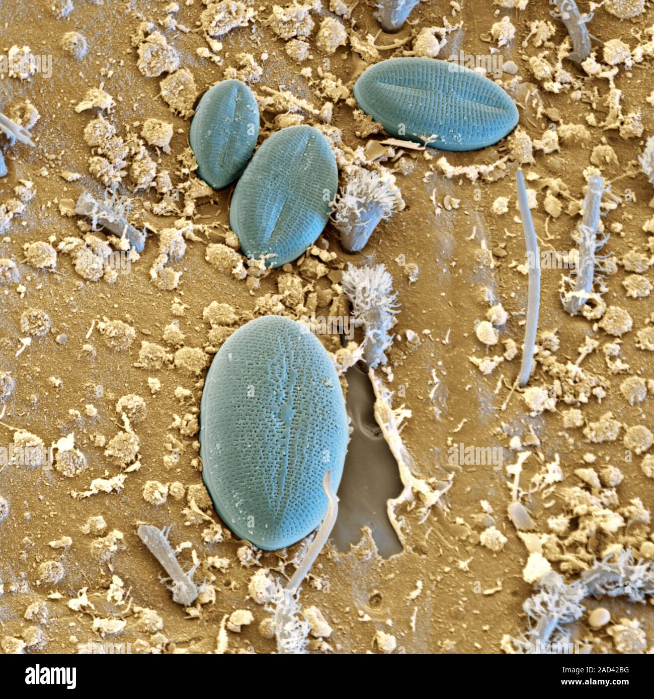 Diatoms on mayfly nymph. Coloured scanning electron micrograph (SEM) of ...