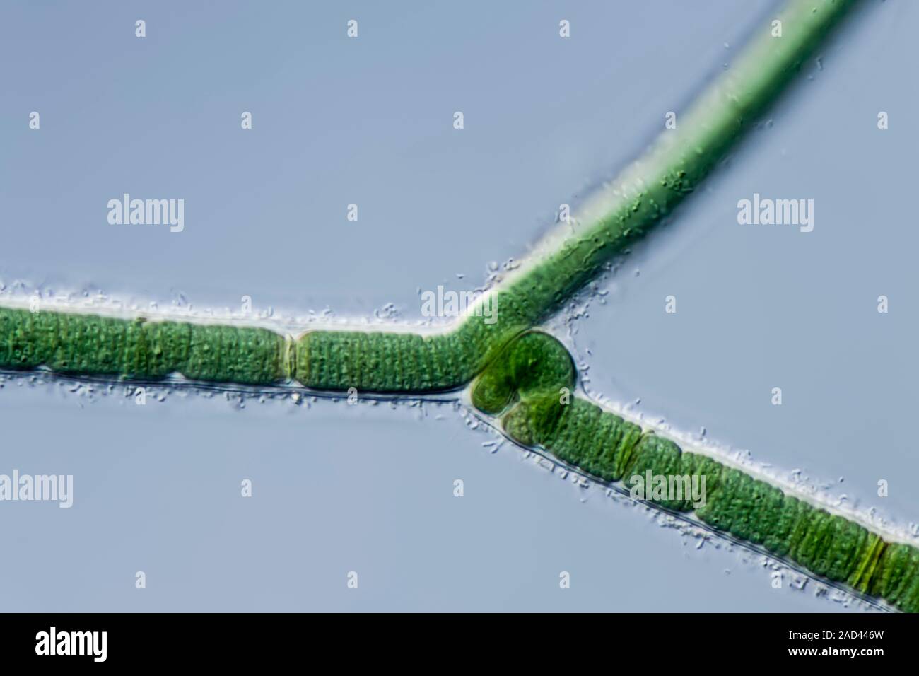 Light micrograph of Calothrix sp., a marine cyanobacterium forming ...