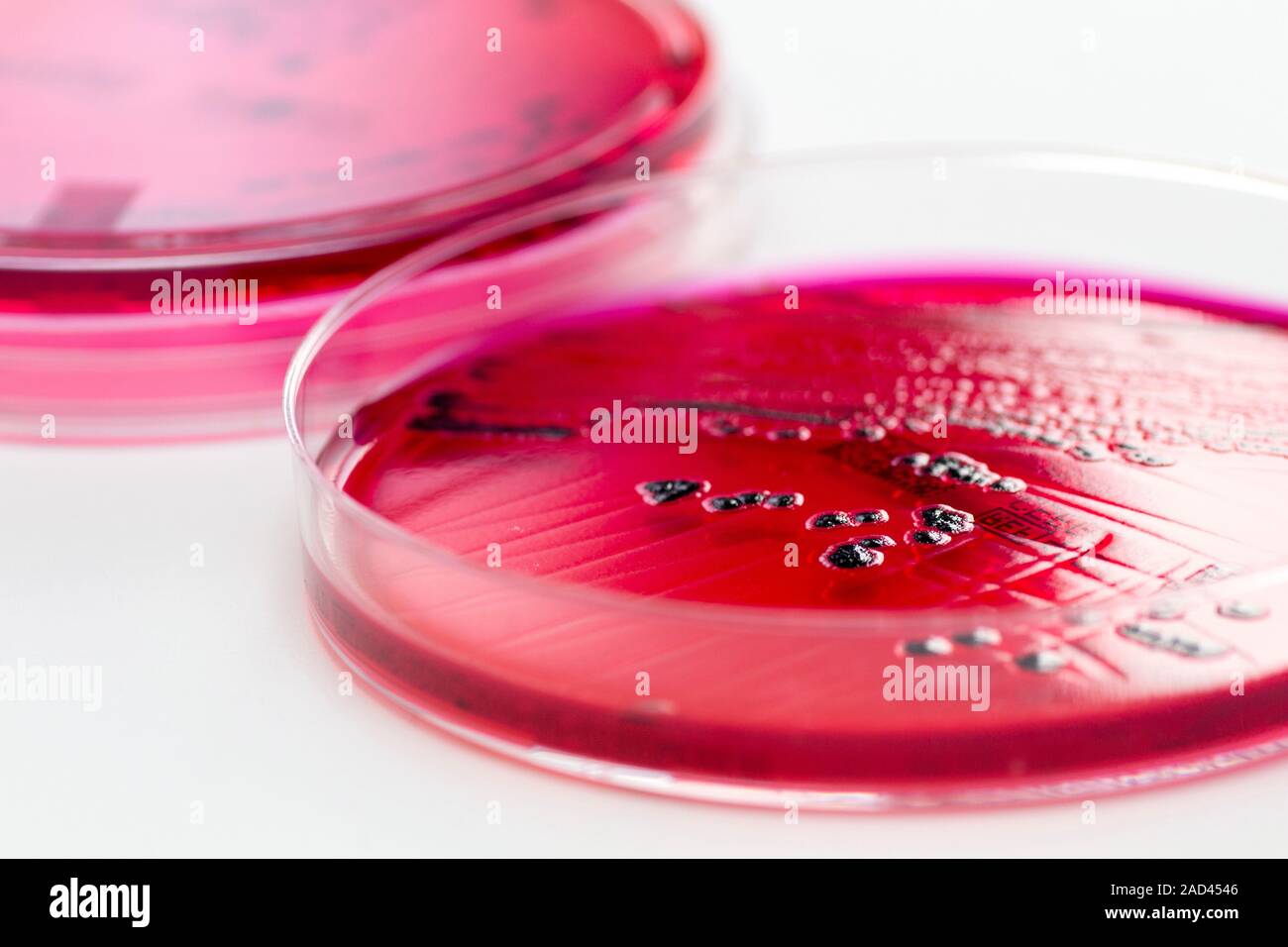 Salmonella enterica bacterial culture on XLDAgar, which is a selective