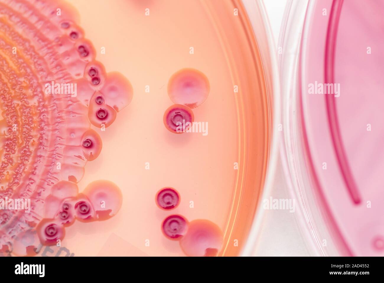 Macro image of mixed cultures of gramnegative bacteria on MacConkey