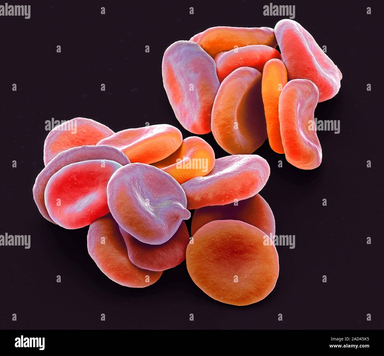 Red blood cells. Coloured scanning electron micrograph (SEM) of red ...