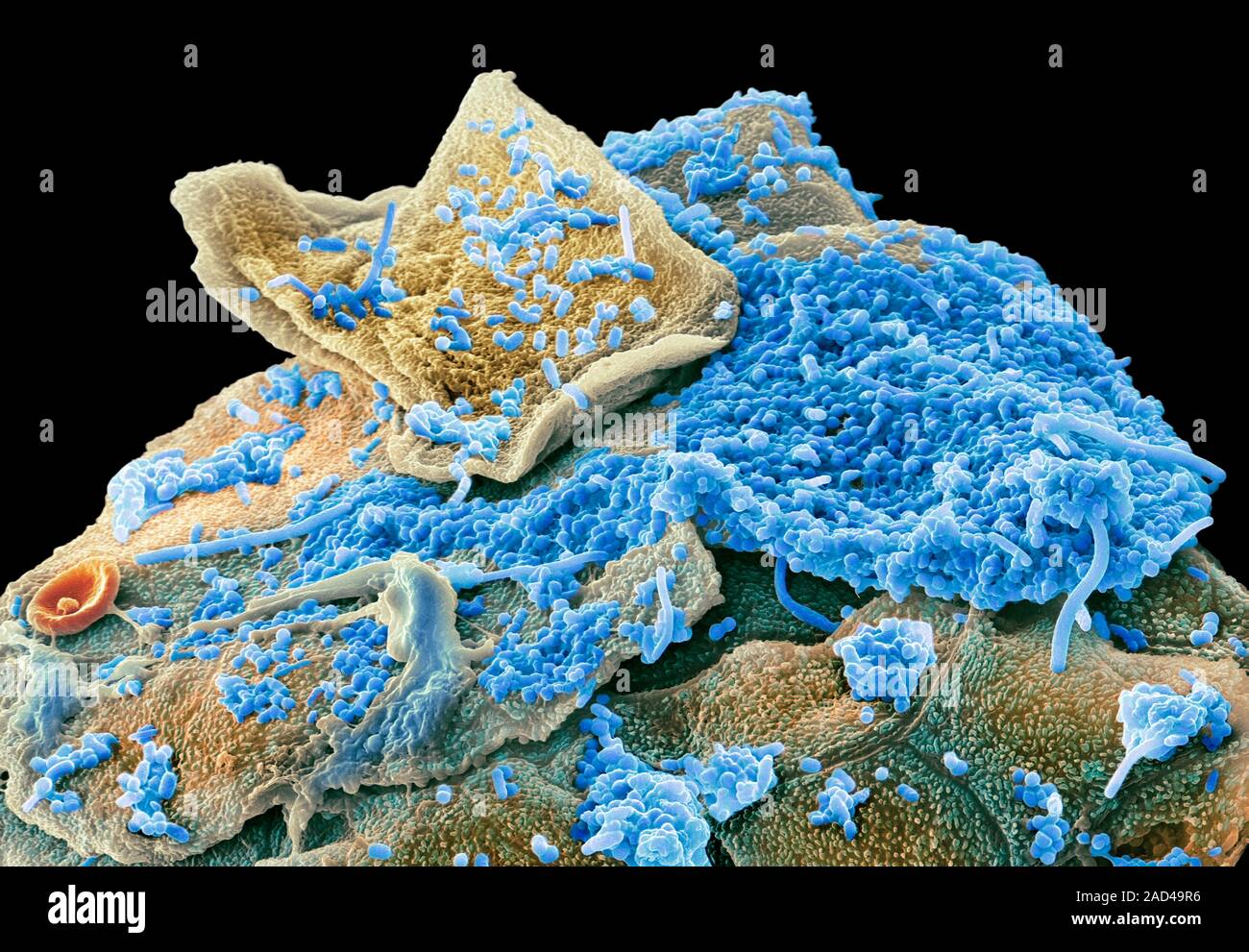 Oral bacteria. Coloured scanning electron micrograph (SEM) of mixed ...