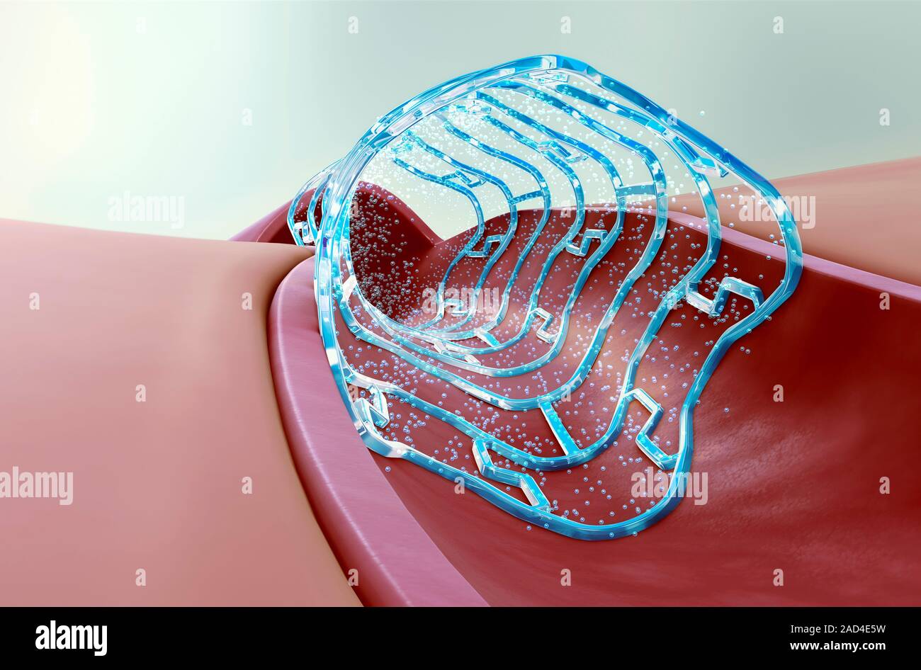 Drugeluting stent. Computer illustration showing a drugeluting stent