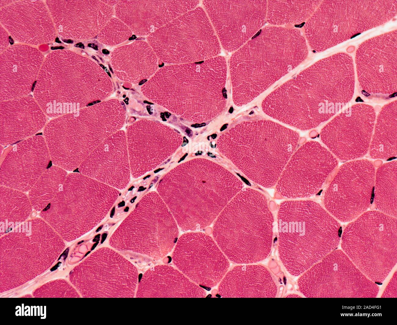 Light Microscopy Of Skeletal Muscle Fibres Seen In Cross Section And Light Microscopy Of Skeletal Muscle Fibres Seen In Cross Section And