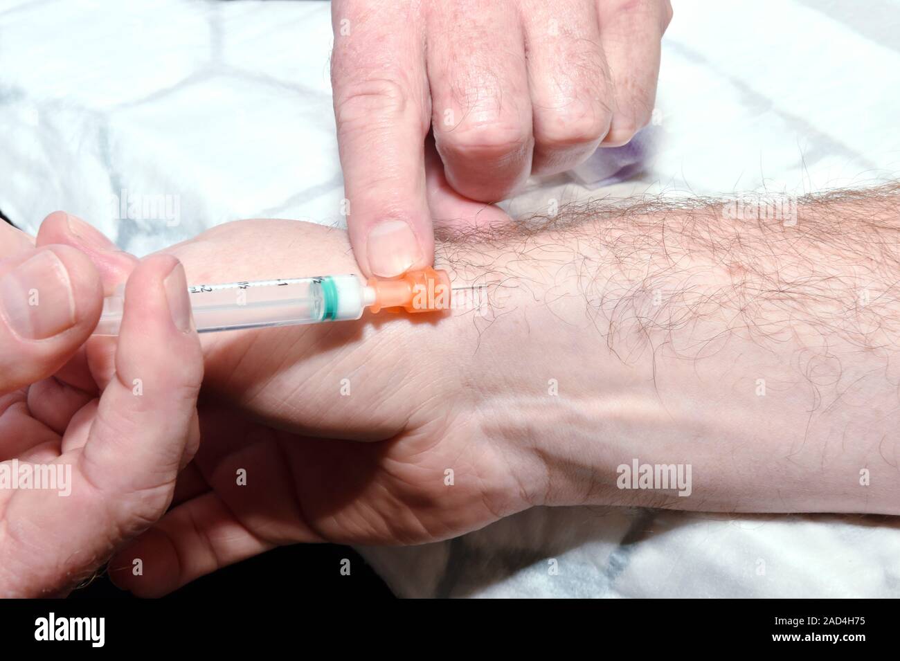 De Quervain syndrome treatment. Patient receiving a corticosteroid ...
