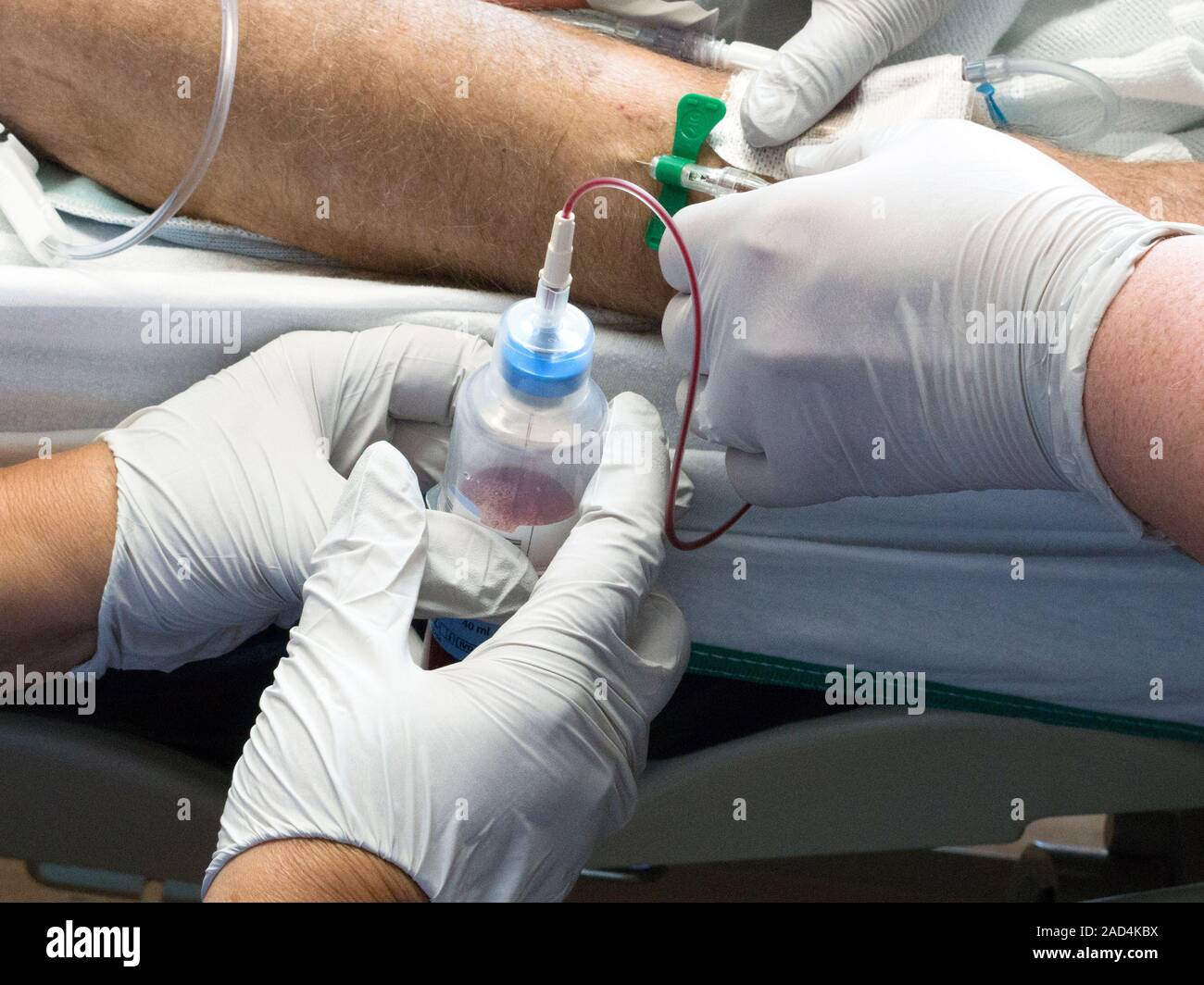 Blood sampling. Nurses using a vacuum bottle to draw a blood sample