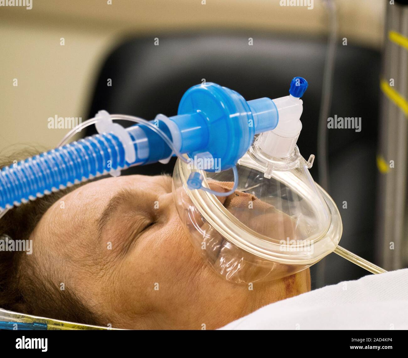 Интубационная трубка ивл. Эндо разеальный наркоз. Проводниковая анестезия нижней челюсти торусальная. Горло после общего наркоза. Почему после наркоза болит горло.