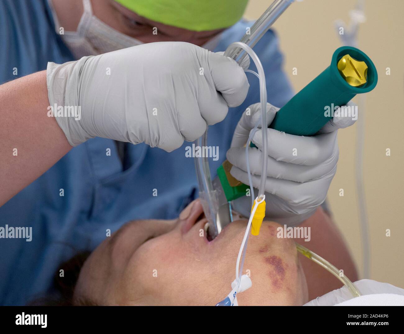 General anaesthesia intubation. Nurse anaesthetist (CRNA) using a