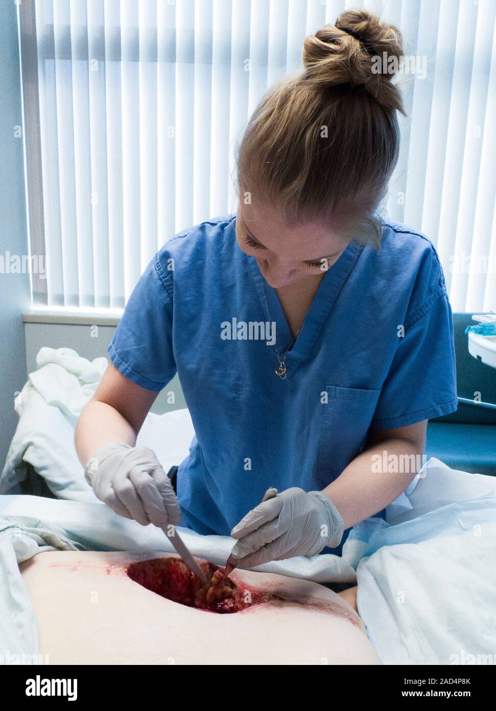 Cleaning infected surgical wound. Doctor using a scalpel and forceps to