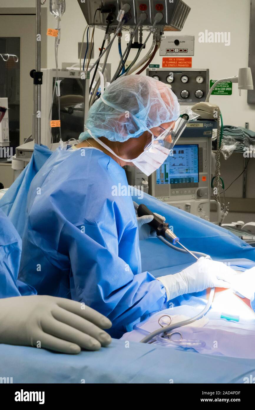Appendix removal surgery. Surgeon using a laparoscope to assess a patient prior to laparoscopic (keyhole) appendectomy (removal of the appendix) for a Stock Photo