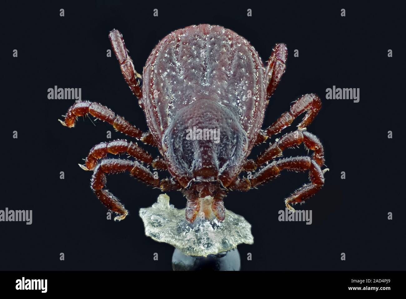 Tick. Macro photograph of a tick (superfamily Ixodoidea) on a piece of human skin (bottom centre). Ticks are parasitic arachnids that feed on blood. M Stock Photo