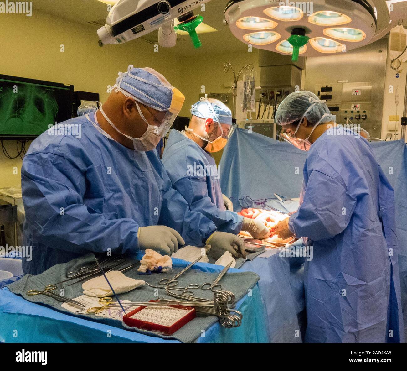 Bowel surgery surgeons performing an exploratory laparotomy to examine