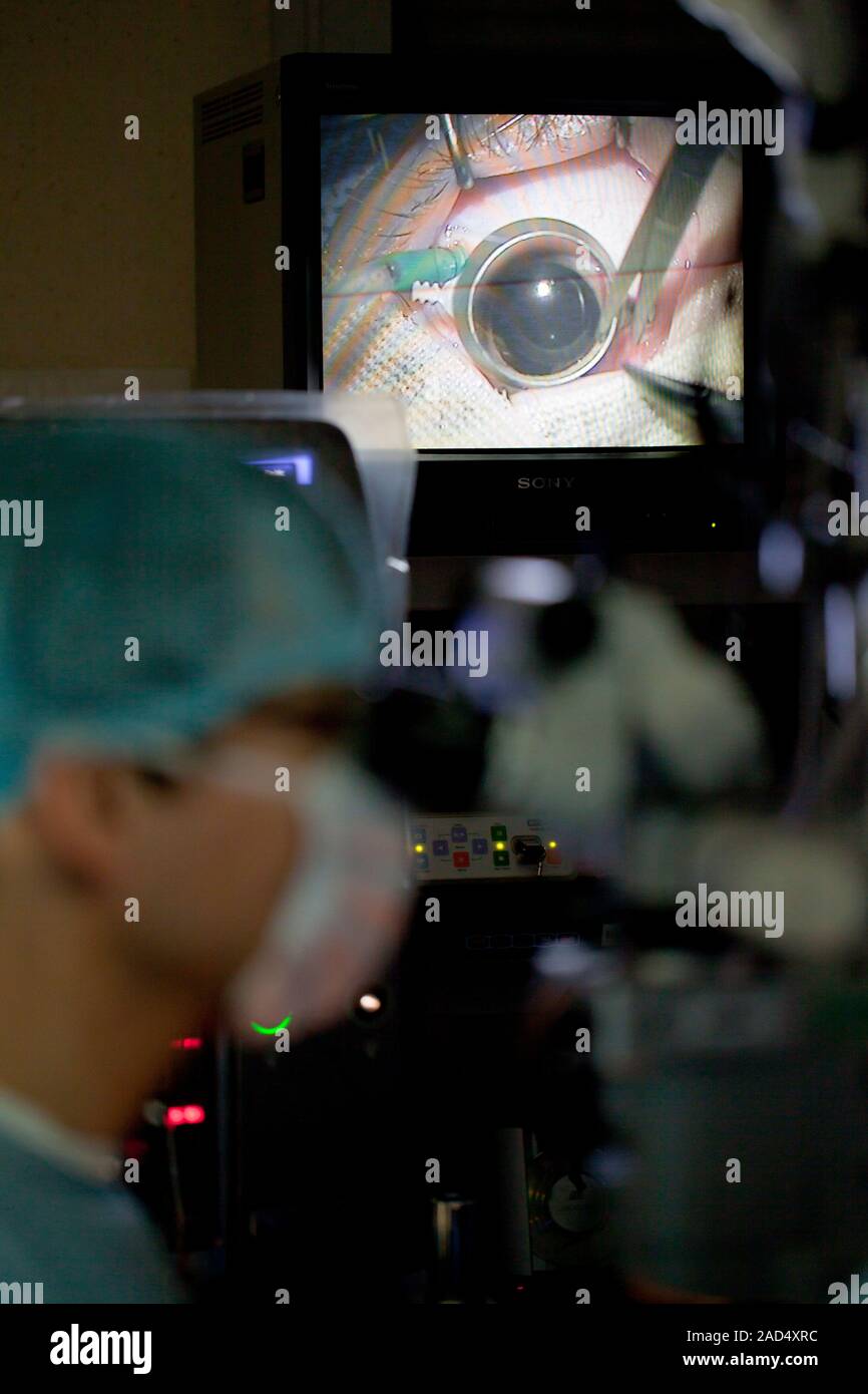 Gene therapy surgical procedure. A surgeon prepares to inject a gene
