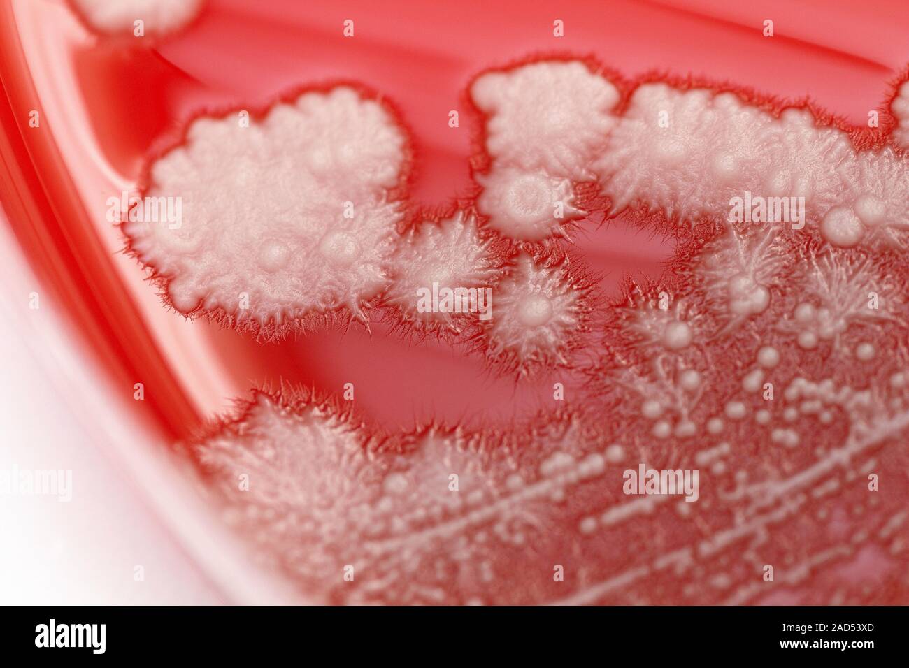 Candida albicans culture growing on Columbia blood agar. Candida