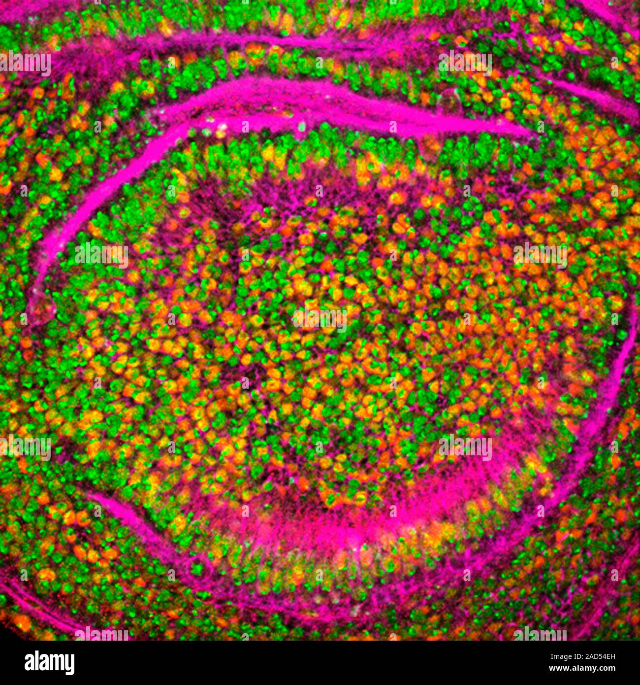 Leukaemia treatment research. Fluorescence light micrograph of tissue ...